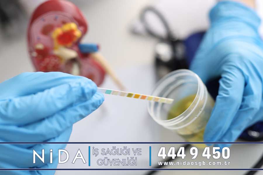 İdrar Tahlili Nedir? Dansite Nedir? - Nida OSGB