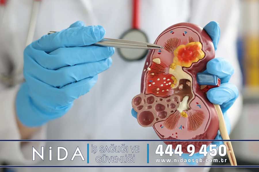 İdrar Tahlili Analizi Pendik, İstanbul - Nida OSGB